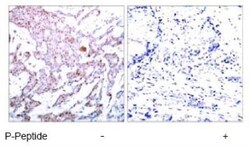 RelA/NFkB p65, p Ser536 Antibody, Novus Biologicals 25 &mu;L; Unconjugated:Antibodies,